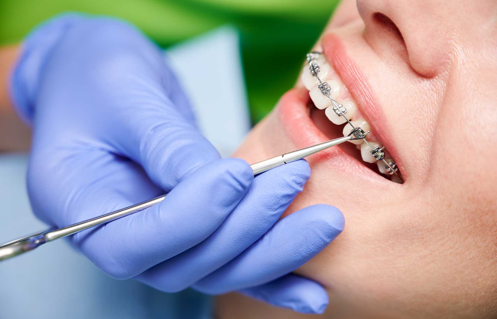 What Does Orthodontic Treatment Include?