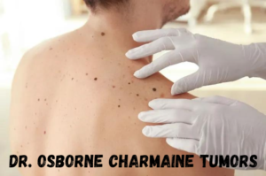 Dr. Osborne Charmaine Tumors